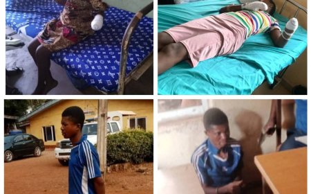 Horror As Enugu Man Cuts Off Wife's Wrist